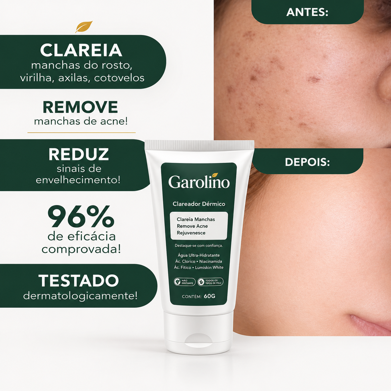 Cicatribem Clareador Dérmico (Edição limitada)